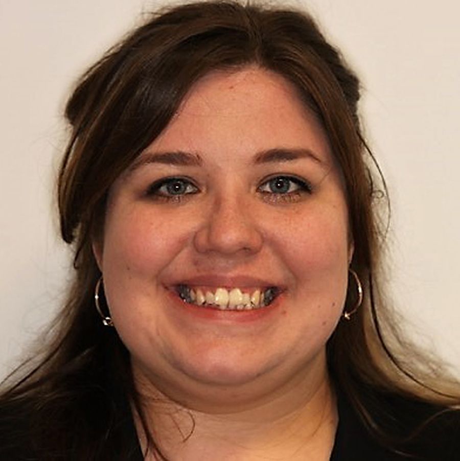 invisalign - Meagan Ní Chuirc - before - 3Dental